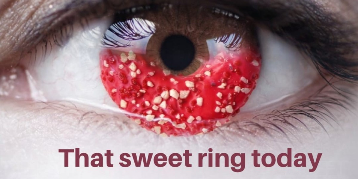 Best Squint Treatment in Raipur: Improve Eye Alignment and Confidence