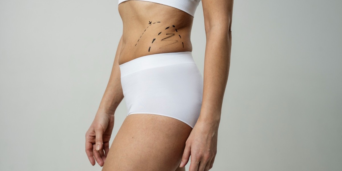 Liposuction Surgery in Dubai Advanced Solutions for Targeted Fat Reduction