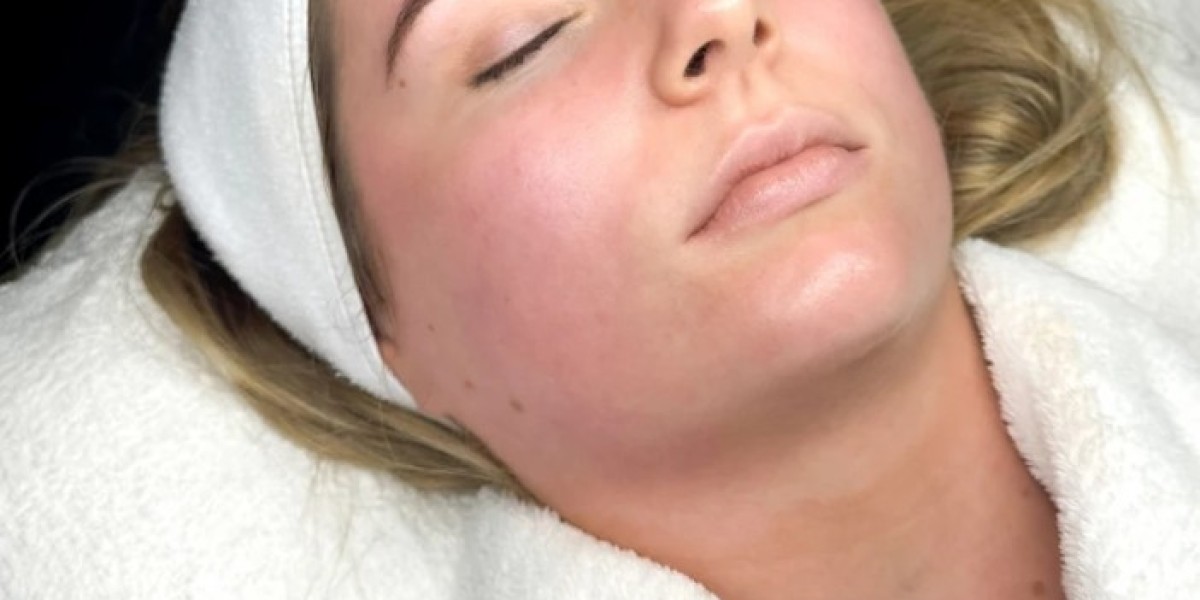 BioRePeel In Manchester – Fresh, Glowing Skin