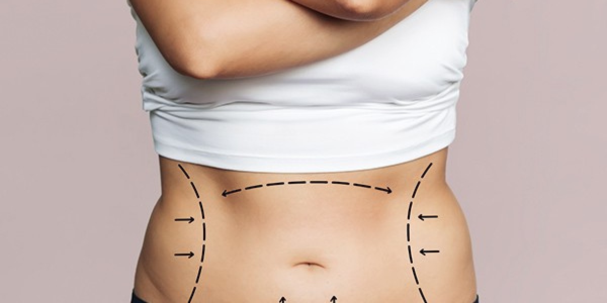 Best Tummy Tuck Surgeon in Dubai: How to Evaluate Your Treatment Options