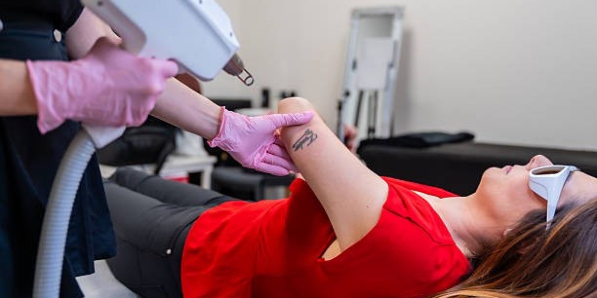 Laser Tattoo Removal in Riyadh: Safety Considerations to Know