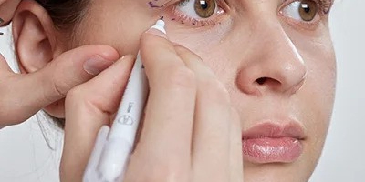 Lower Blepharoplasty In Dubai: Refresh The Lower Eyes