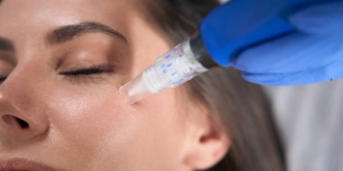 Best DermaPen in Riyadh Treatments for Smoother, Healthier-Looking Skin