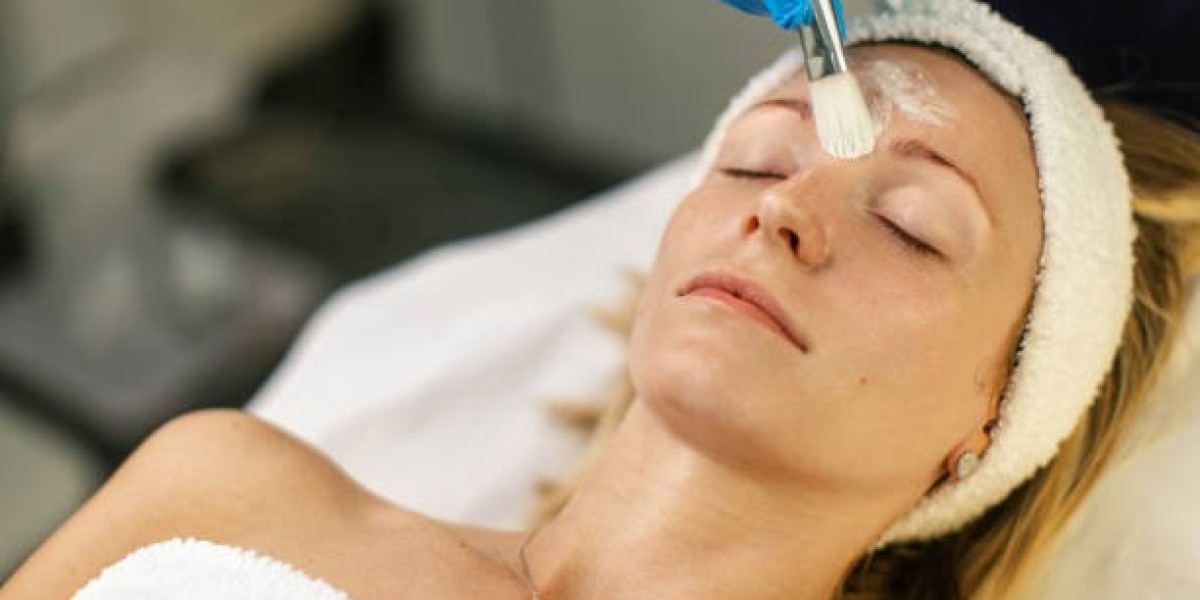 Chemical Peels in Riyadh for Acne-Prone Skin