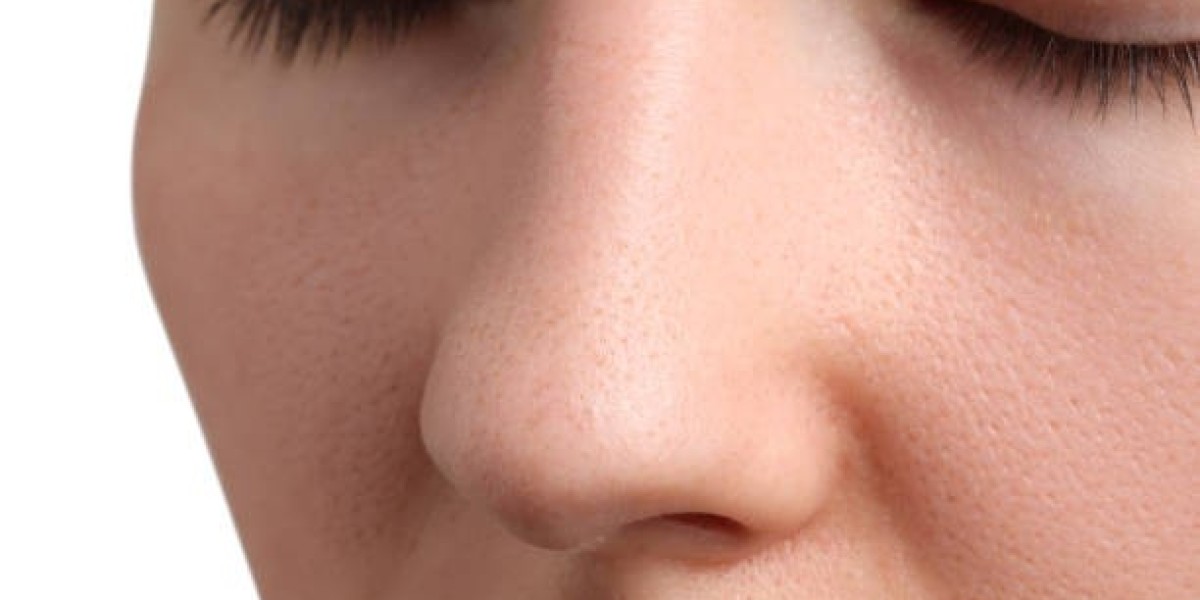Alarplasty Education: How Surgeons Plan Nostril Reduction