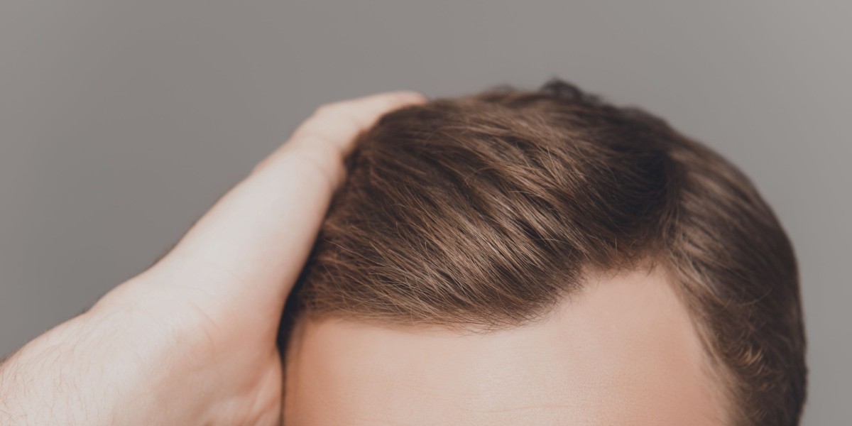 Choosing Hair Texture for Hair Replacement in Dubai