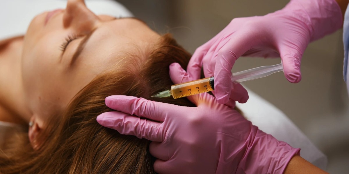 PRP Hair Treatment Dubai: What Factors Affect Treatment Results?