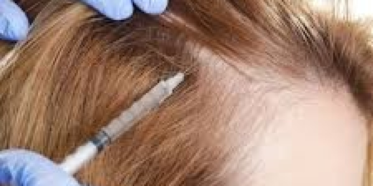 PRP in Dubai: Encourage Skin Renewal and Support Hair Growth